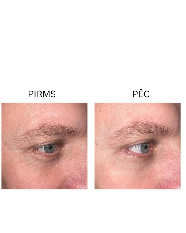 Peptilux “Shock Action” acu kontūru krēms